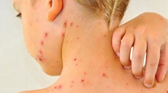  ����� ������������� ��� ������� ����������� ����� 