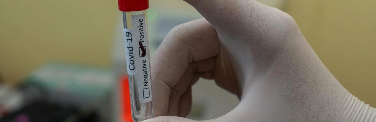  ����������� ����� ��������� ���������� covid-19 ������� ������� 