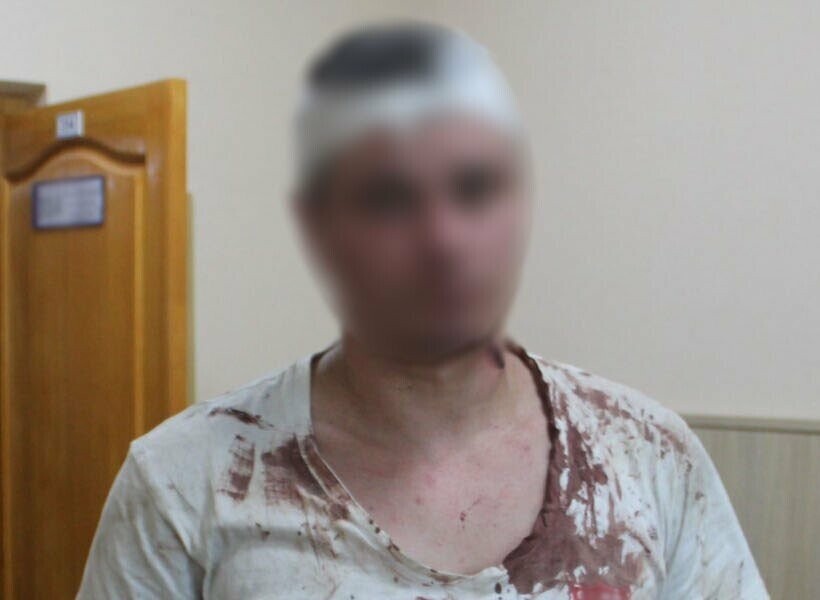У Києві чоловік напав на свого товарища з ножем і тяжко поранив його у живіт, – ФОТО У Києві чоловік напав на свого товарища з ножем і тяжко поранив його у живіт, – ФОТО