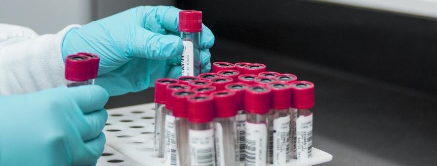 Безкоштовне та конфіденційне обстеження: на Київщині відкриють мобільну амбулаторію Безкоштовне та конфіденційне обстеження: на Київщині відкриють мобільну амбулаторію