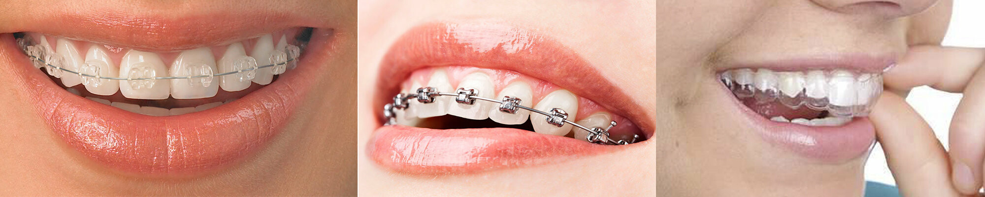 Ортодонтия﻿, фото-1