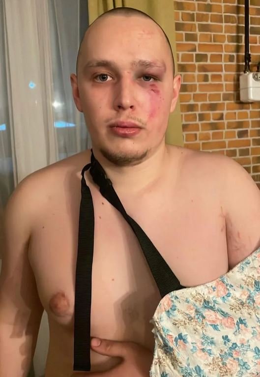 Ветерана Олексія Іваніна побили в лікарні