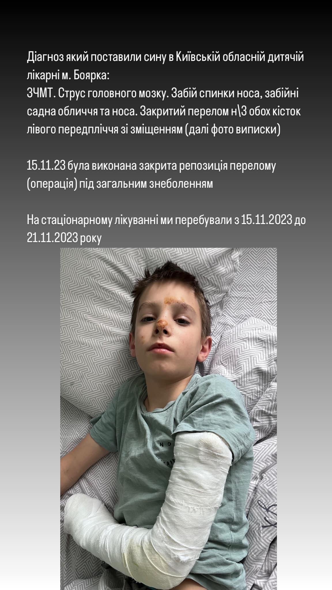 На Київщині дитину зіштовхнули у школі з висоти