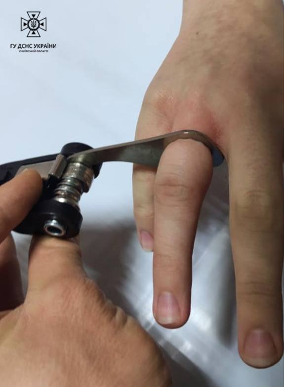 Рятувальники допомогли підлітку