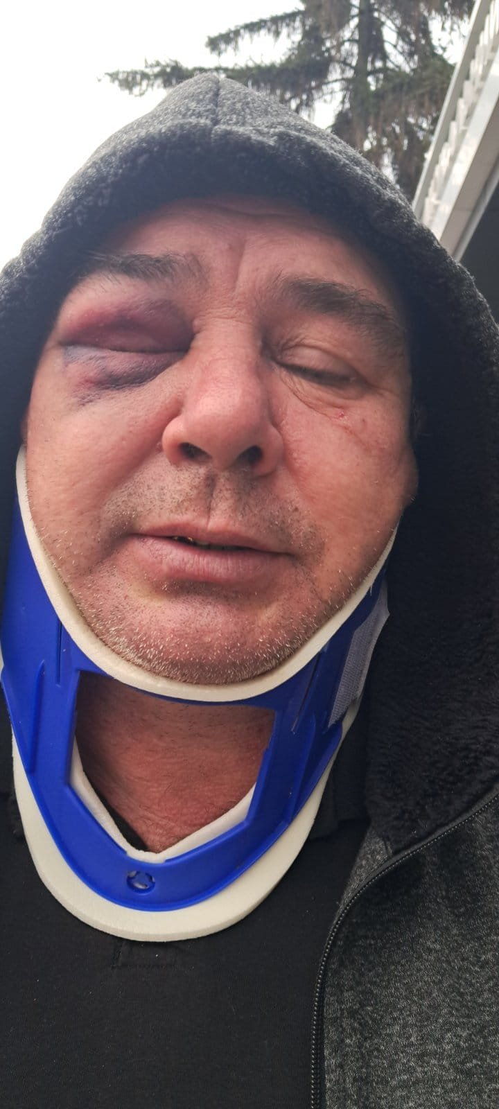 Скандал з ТЦК на Київщині