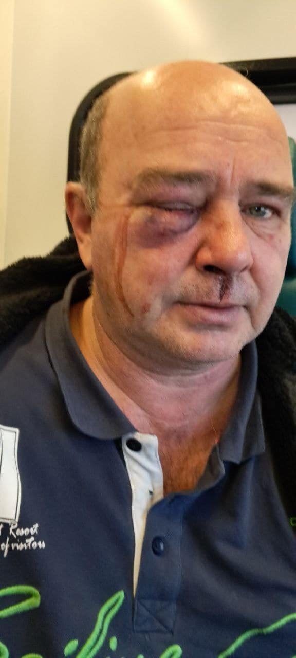 Скандал з ТЦК на Київщині