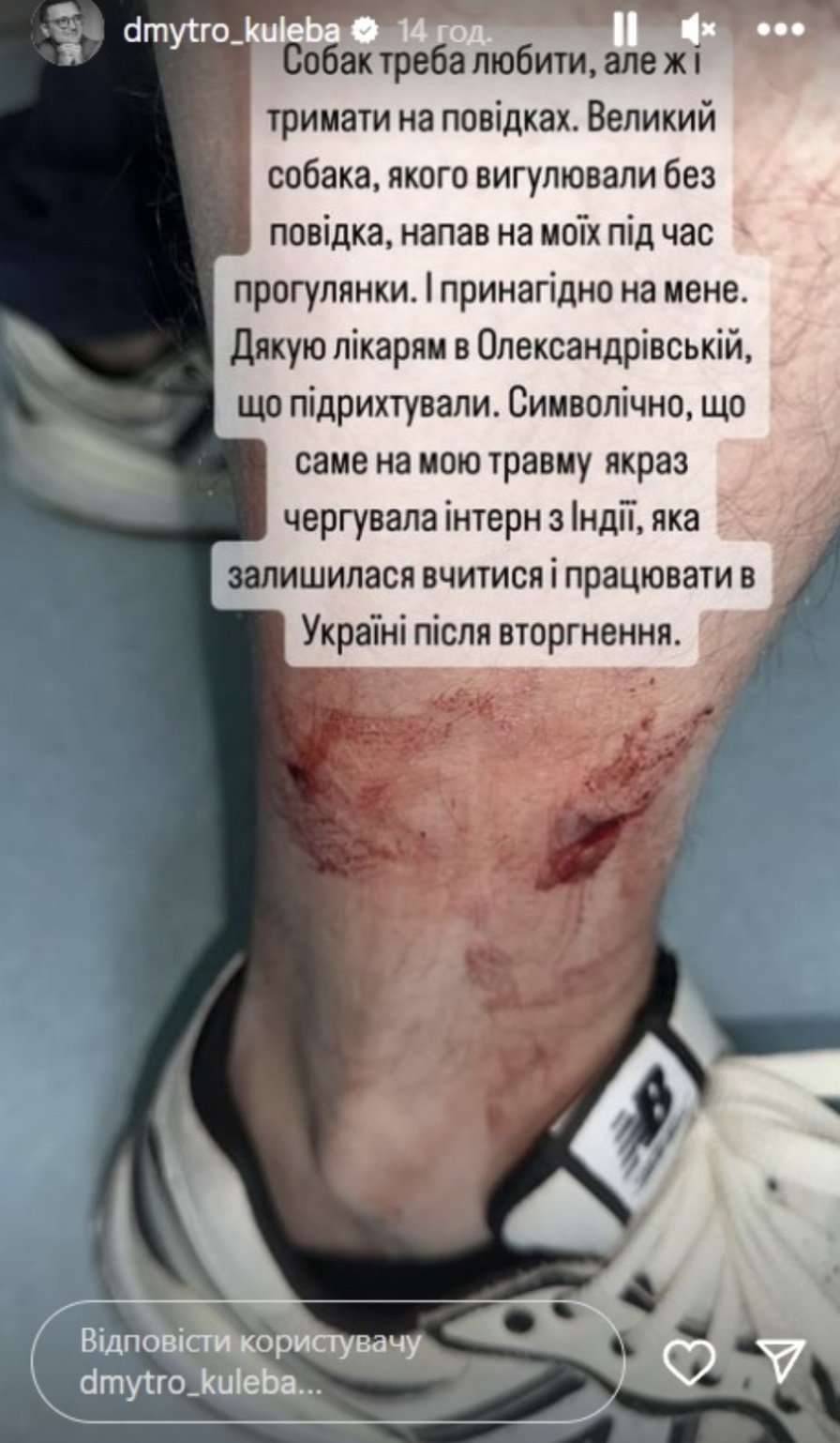 Главу МЗС у Києві покусав чужий собака