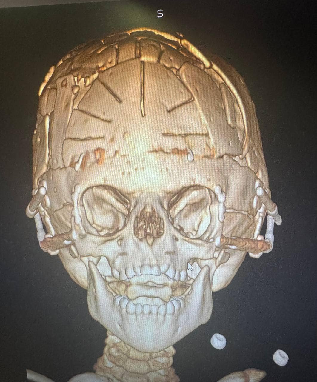 Такі операції будуть і далі проводитись