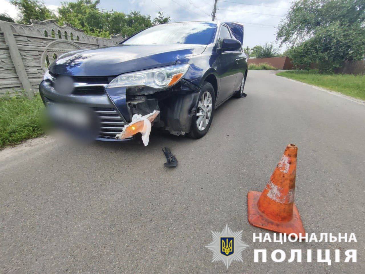 Маленького водія велосмпеда забрали до лікарні